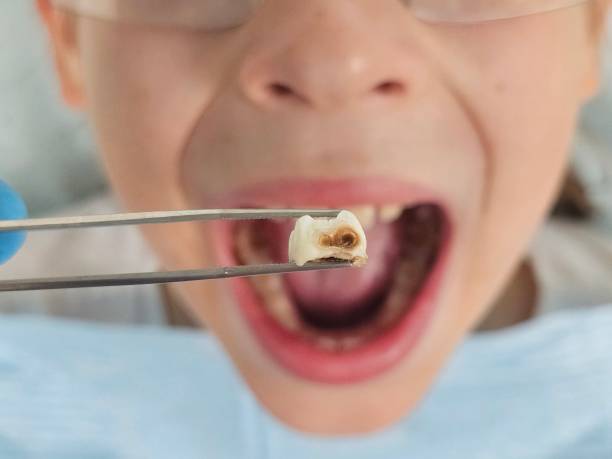 Best Emergency Treatment for Toothache in , AR